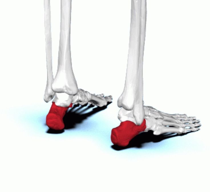 <p>Heel of foot</p>