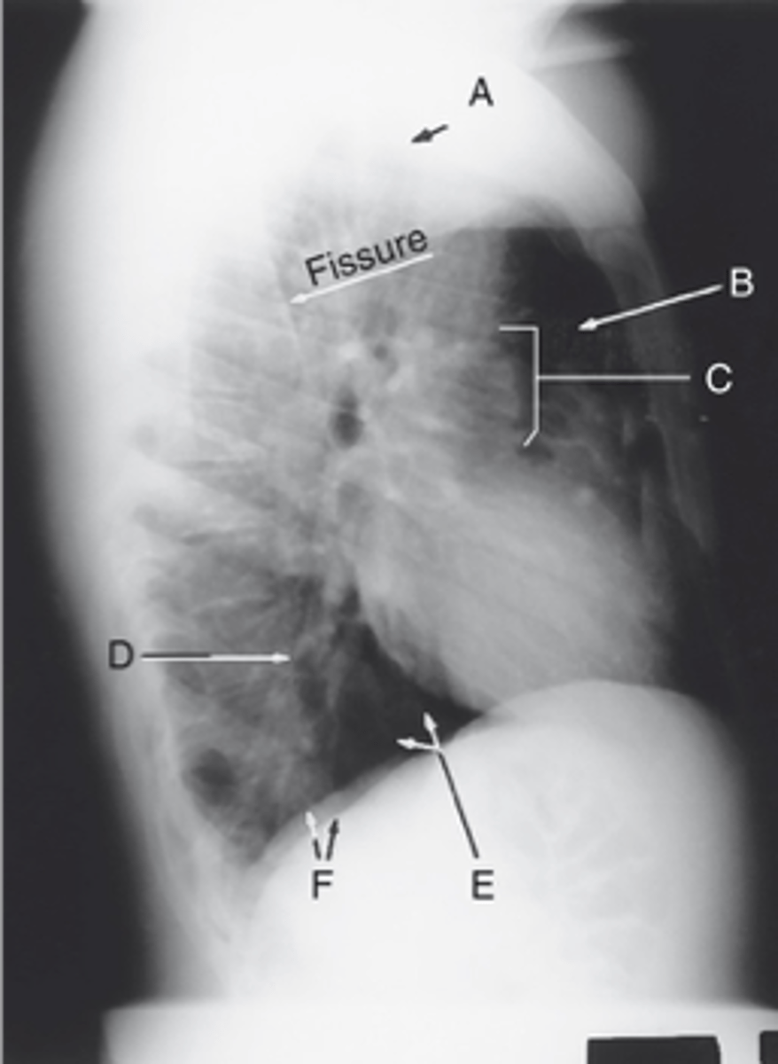 <p>Label: A</p>