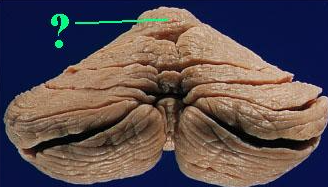 <p><span>Identify the indicated lobe of the cerebellum.</span></p>