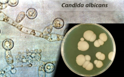 <p>Candida albicans</p>