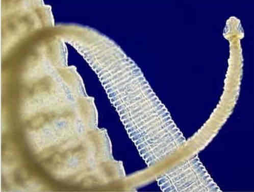<p>Pork tapeworm (cestoda) parts </p>