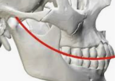 <p><span style="background-color: transparent;"><strong>The curved alignment of all teeth when viewing occlusal plane of the mandibular posterior teeth from the buccal&nbsp;</strong></span></p><ul><li><p><span style="background-color: transparent;"><strong>Know definition and what it looks like (viewed from buccal)</strong></span></p></li></ul><p></p>
