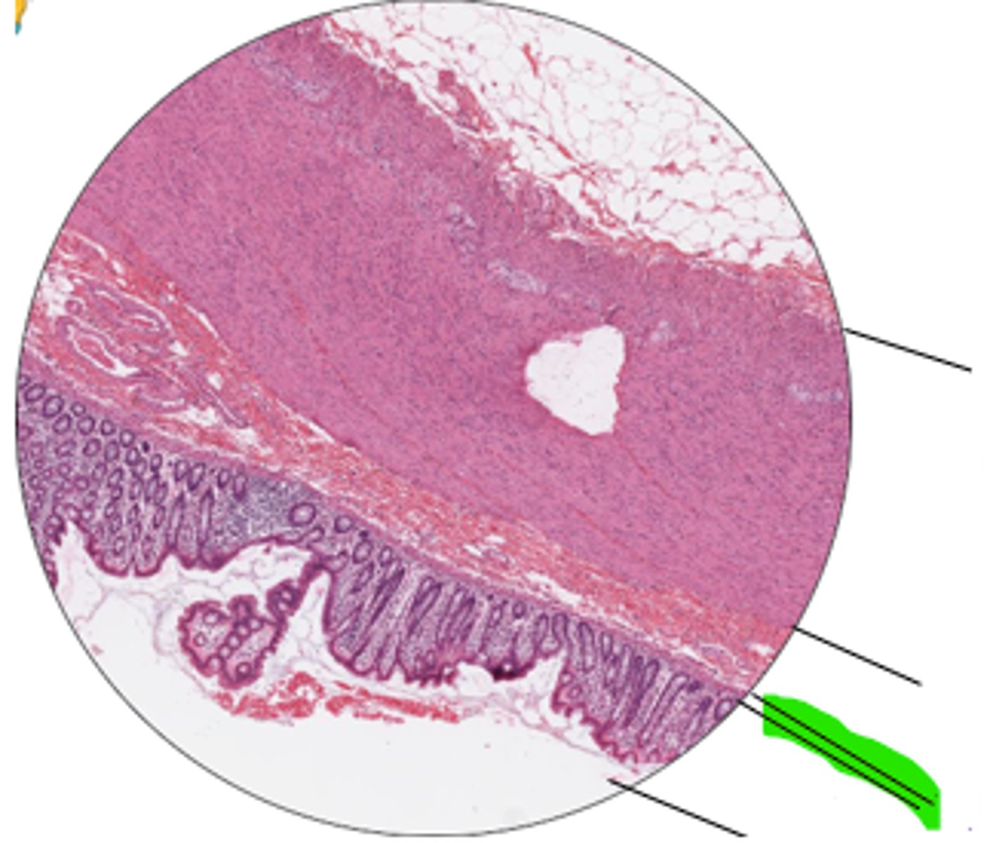 <p>region and organ?</p>