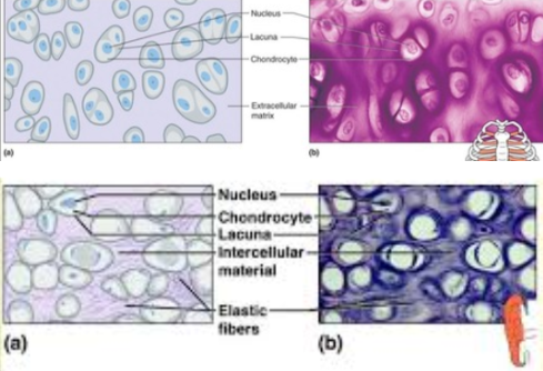 <p><span><strong>1. a rigid connective tissue </strong>that <strong>provides a supportive framework</strong> for various structures.<strong> It lacks a vascular system and so heals slowly.</strong></span><br><br><span><strong><em>5 types of BLANK (CCHEF)</em></strong></span></p><p style="text-align: justify"><span><strong>2. Cartilage cells (chondrocytes)</strong> lie within&nbsp; lacunae in the gel-like fluid matrix.</span></p><p style="text-align: justify"><span><strong>3. Cartilaginous structures </strong>are enclosed within a connective tissue <strong>perichondrium.</strong></span></p><p style="text-align: justify"><span>4. The most common,<strong> hyaline cartilage, </strong>is white with abundant fine collagen fibers, is found at the ends of bones, and supports respiratory passages.</span></p><p style="text-align: justify"><span><strong>5. Elastic cartilage, </strong>with elastic fibers, provides a framework for the external ears and parts of the larynx.</span><br><span><strong>6. Fibrocartilage, </strong>with many collagenous fibers, is a tough tissue that provides a shock-absorbing function in intervertebral disks, knees and pelvic girdle.</span></p>