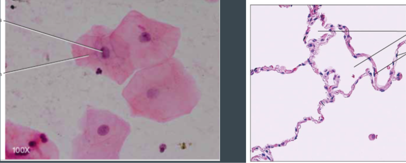 <p>(epithellial) single layer of flat cells</p>