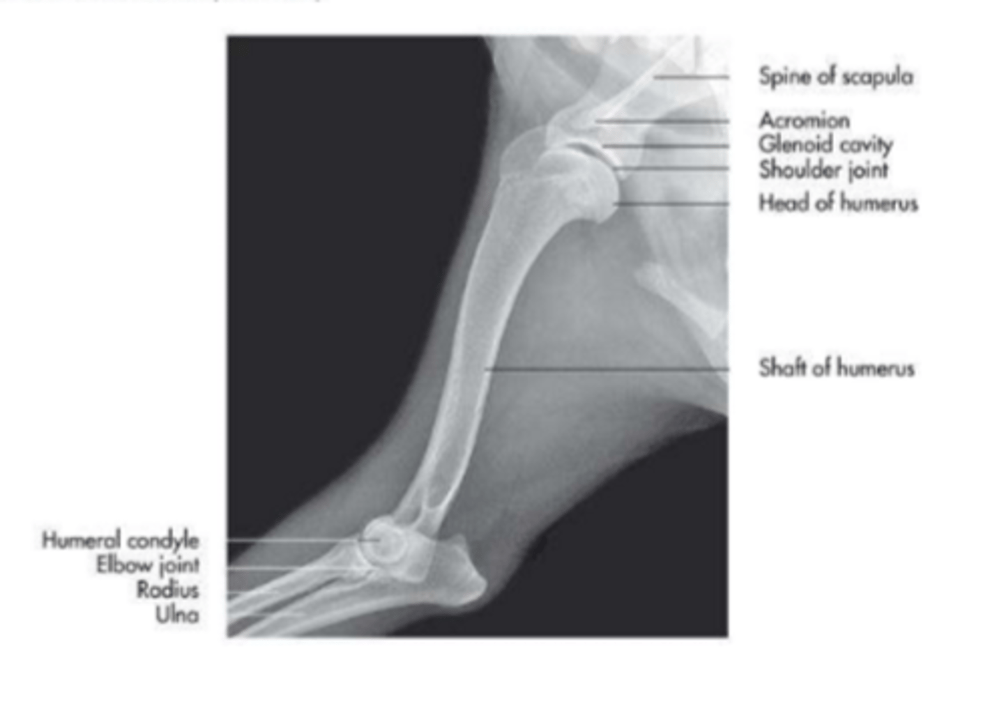 <p>glenohumeral (shoulder) joint</p>