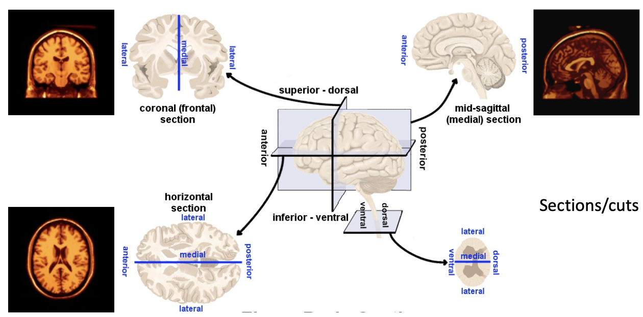 <ul><li><p>coronal (frontal) section</p></li><li><p>horizontal section</p></li><li><p>mid-sagittal (medial) section</p></li></ul><p></p>