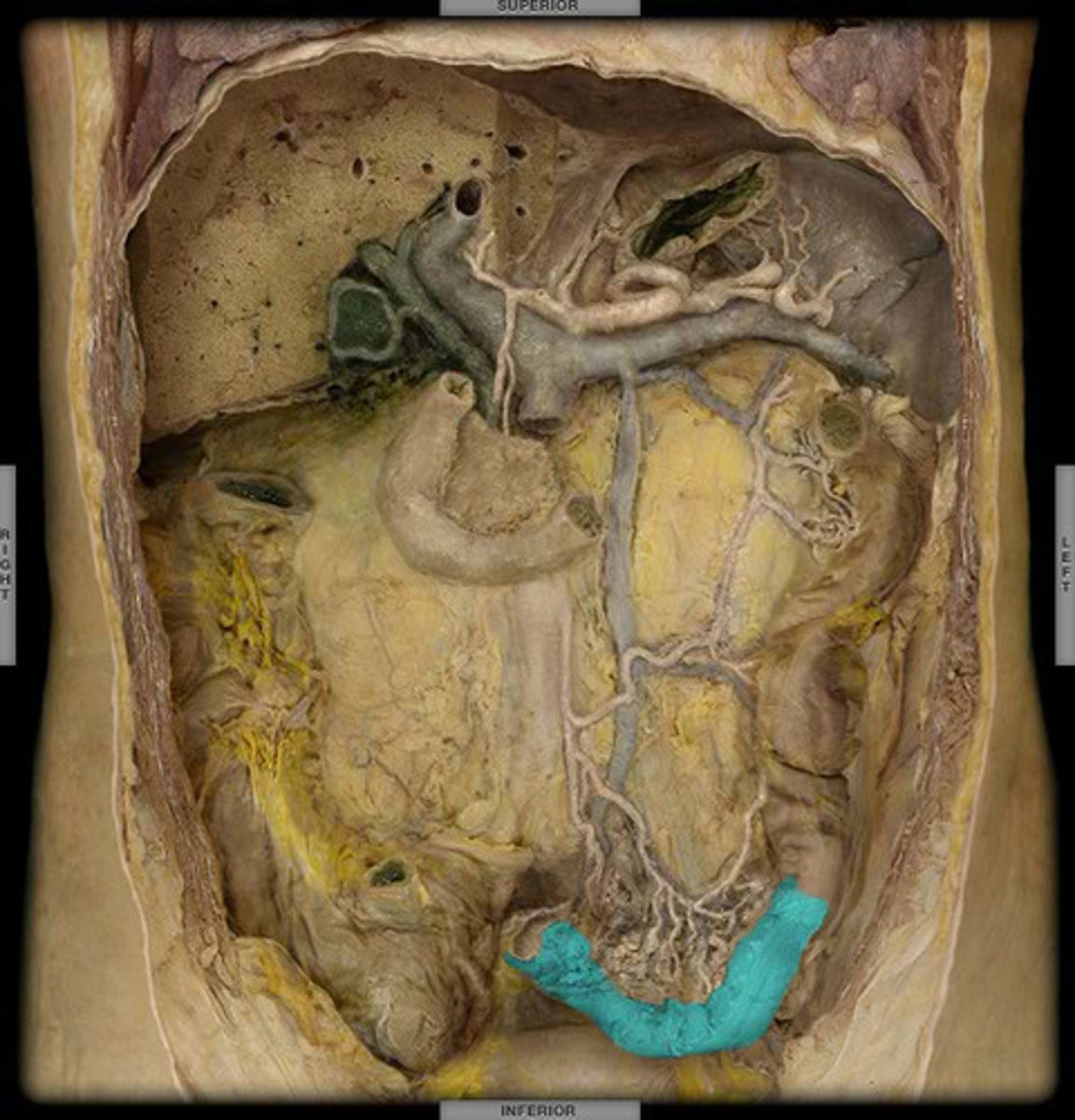 <p>the S-shaped portion of the colon between the descending colon and the rectum</p>