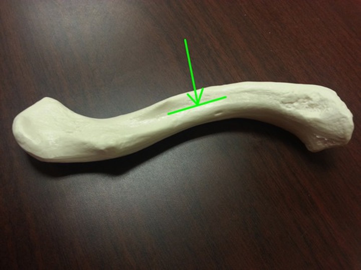 <p>Groove for subclavian artery on clavicle.</p>