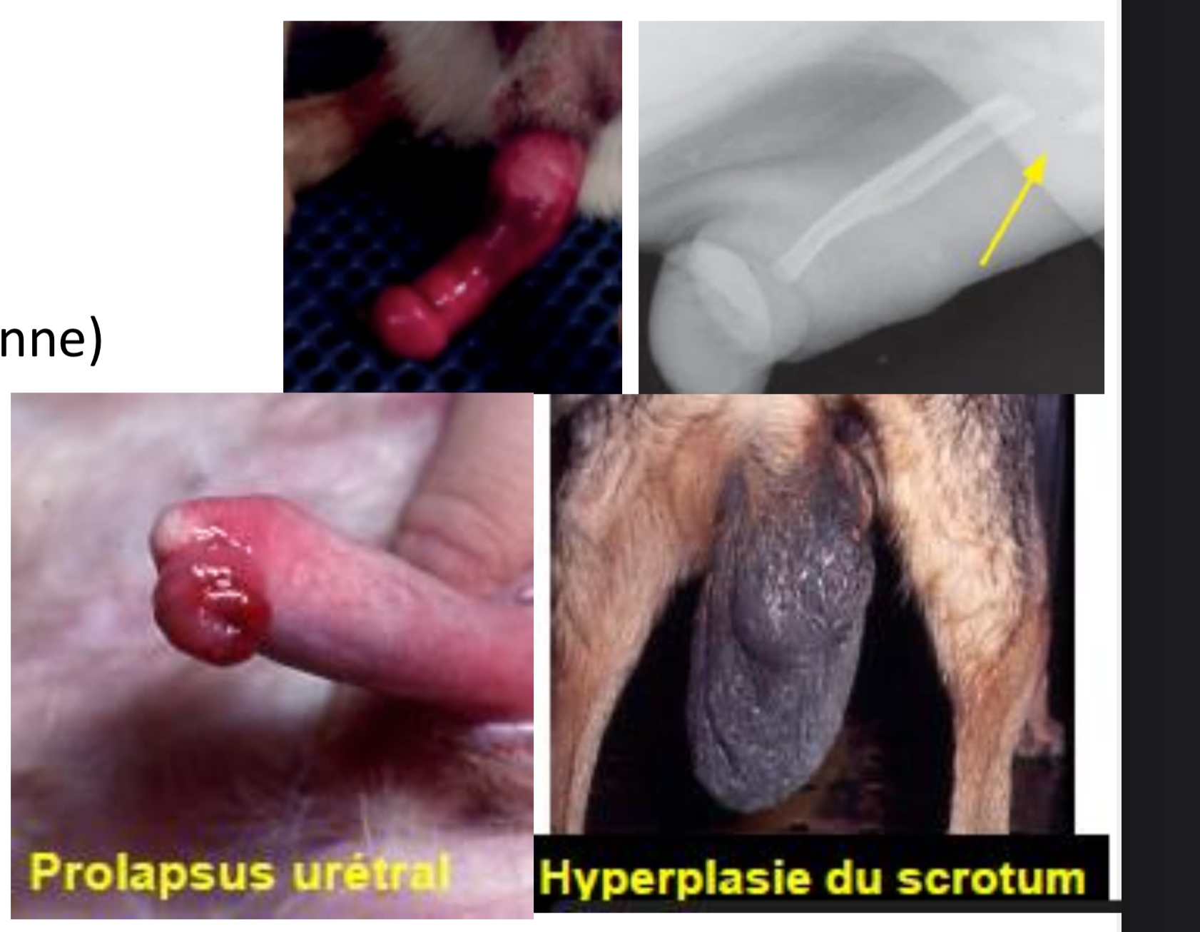 <p>1.<strong> </strong>Gangrène du pénis</p><p>Consécutif à un paraphimosis, un traumatisme (séparation lors du rapport).</p><p>2.<strong> </strong>Fracture de l’os pénien (cf photos ci-contre)</p><p>Œdème important, miction difficile/impossible, crépitation à la palpation.</p><p>Diagnostic : sonde pour voir s’il urine + radiographie</p><p>Traitement : sonde + urétérostomie (faire un méat en position rétro pénienne)</p><p>3.<strong> </strong>Prolapsus urétral (cf photo gauche)</p><p>Fourreau retourné, excès de muqueuse qui peut devenir nécrotique.</p><p>Sortie de l’urètre, manchon cylindrique à remettre en place avec cathéter</p><p>urétral + bêtalactamines</p><p>4.<strong> </strong>Hyperplasie scrotale (cf photo droite)</p><p>Phénomène de cale au niveau du scrotum : diffus, localisée aux zones de</p><p>contact. Si ça gène le chien : exérèse partielle du scrotum.</p><p>5.<strong> </strong>Varice du pénis</p><p>Passe souvent inaperçue : provoque des saignements, on peut les cautériser sous anesthésie générale + pommade</p><p>pour éviter les adhérences.</p><p>6.<strong> </strong>Paralysie et protusion du pénis</p><p>Paralysie d’origine médullaire des muscles rétracteurs du pénis → risque traumatique.</p><p>7.<strong> </strong>Priapisme</p><p>Erection permanente, involontaire, sans augmentation de la libido.</p><p>Causes : infection génitales et urinaires, compression des veines honteuses.</p><p>Traitement : anesthésie générale (barbituriques) pour résoudre les pbs + soins locaux/</p><p>8.<strong> </strong>Spermatocèle</p><p>Distension kystique du système testiculaire : obstruction de l’épididyme (palpable).</p><p>9.<strong> </strong>Torsion testiculaire :</p><p>Rotation du testicule autour de son axe vertical. Baisse état général très brutal → exérèse.</p>