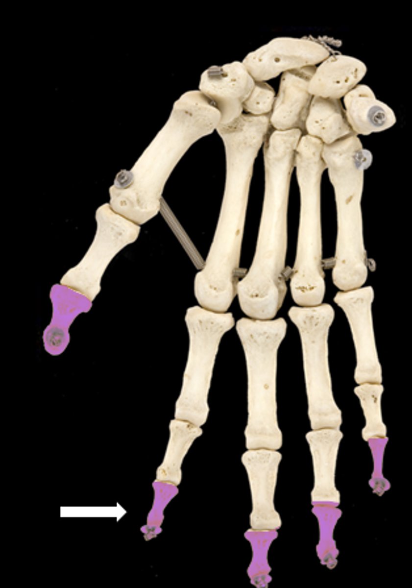 <p>name the part</p>
