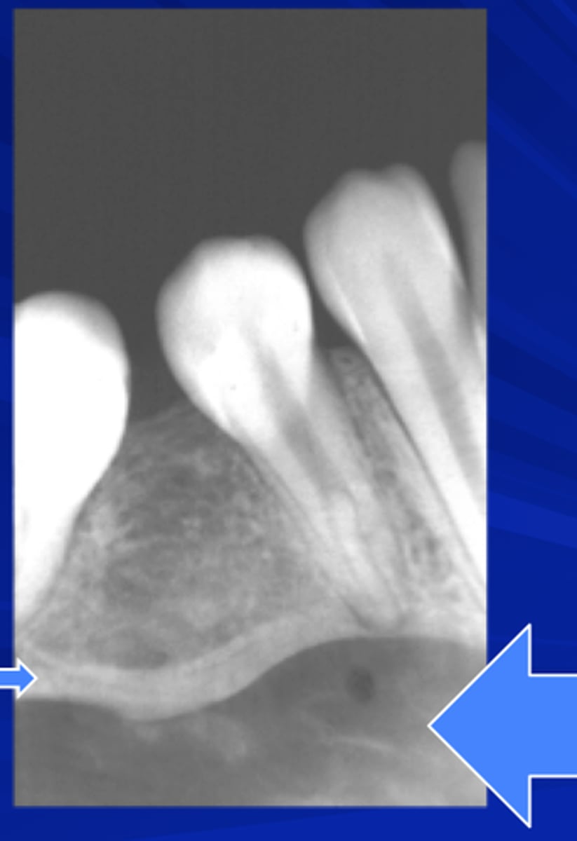 <p>Arrow on left (small)? <br>Arrow on right (large)?</p>