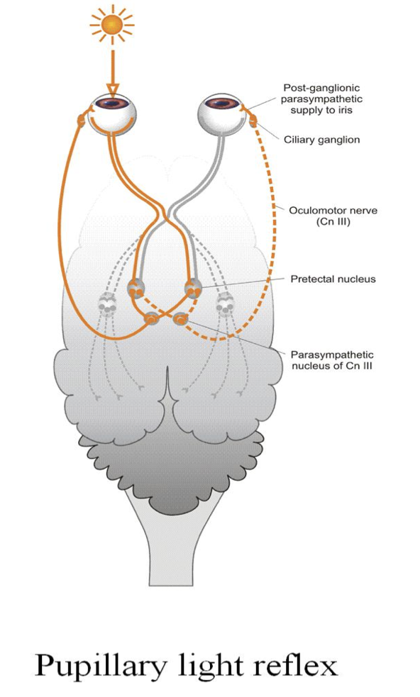<p>PLR = shining a bright light in ONE eye… should see BOTH pupils contract&nbsp;</p><ul><li><p>Tests the function of the<strong> Optic Nerve (CN II)</strong>&nbsp;→ optic chiasm → optic tract → Pretectal nucleus →&nbsp;<strong>Parasympathetic nucleus of Oculomotor nerve (CN III)</strong> pathway&nbsp;</p></li></ul><p></p><p>** CN III = oculomotor nerve = constriction of the pupil </p><p></p>
