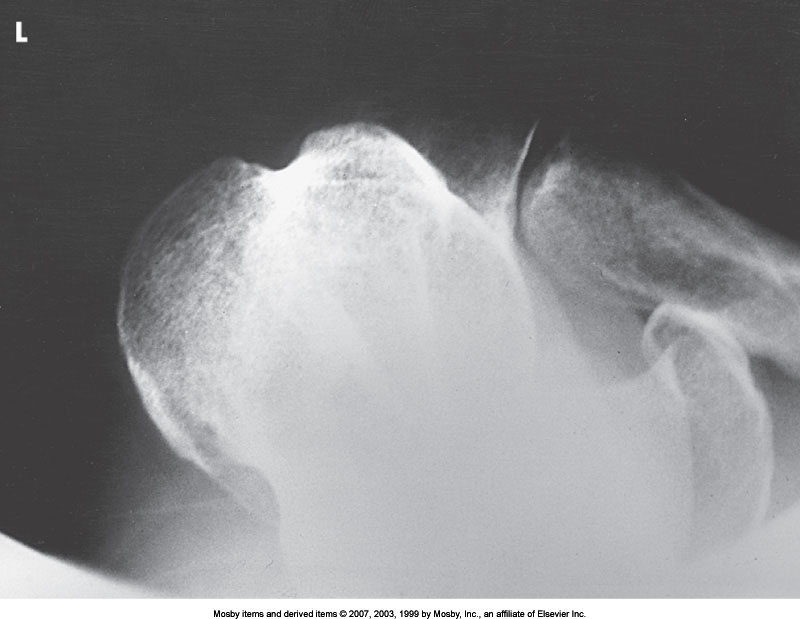 <p>What position is demonstrated?</p>