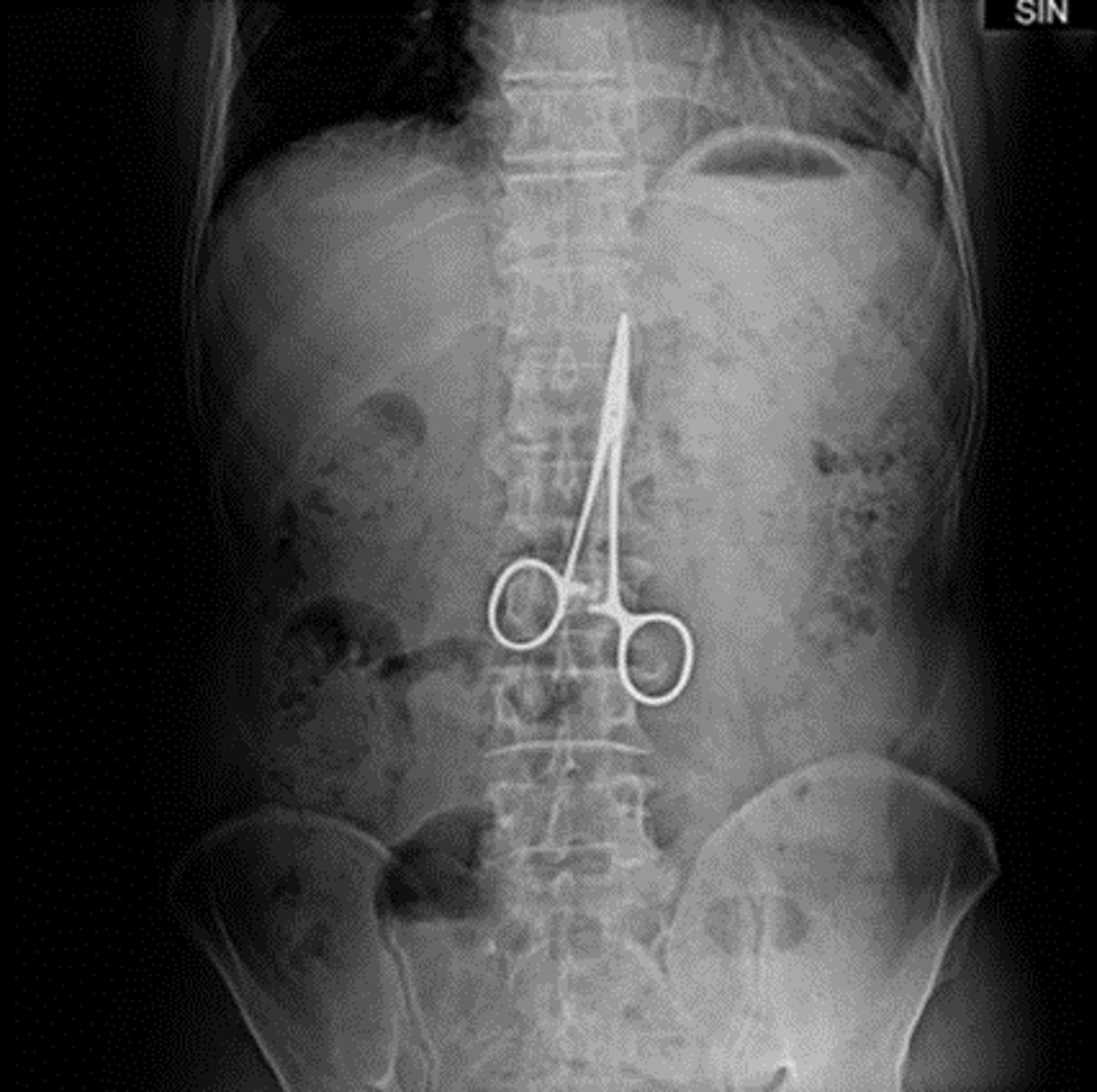<p>The cause of negligence is obvious-- the thing speaks for itself</p>