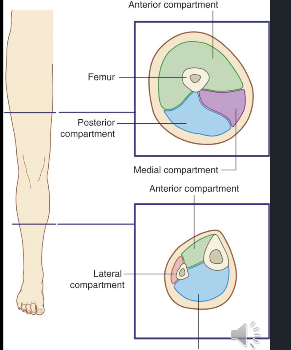 <p>There is thick fascia separating groups of muscles divided into an anterior compartment, a posterior compartment, and a medial compartment.</p><ul><li><p>Compartments are important for two things: muscle ID, and compartment syndrome. </p></li></ul><p></p>