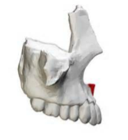 <p>Which maxilla marking is this? (1)</p>