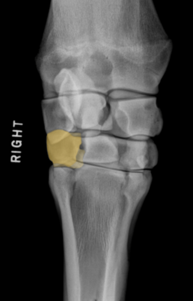 <p>What bone is highlighted?</p>