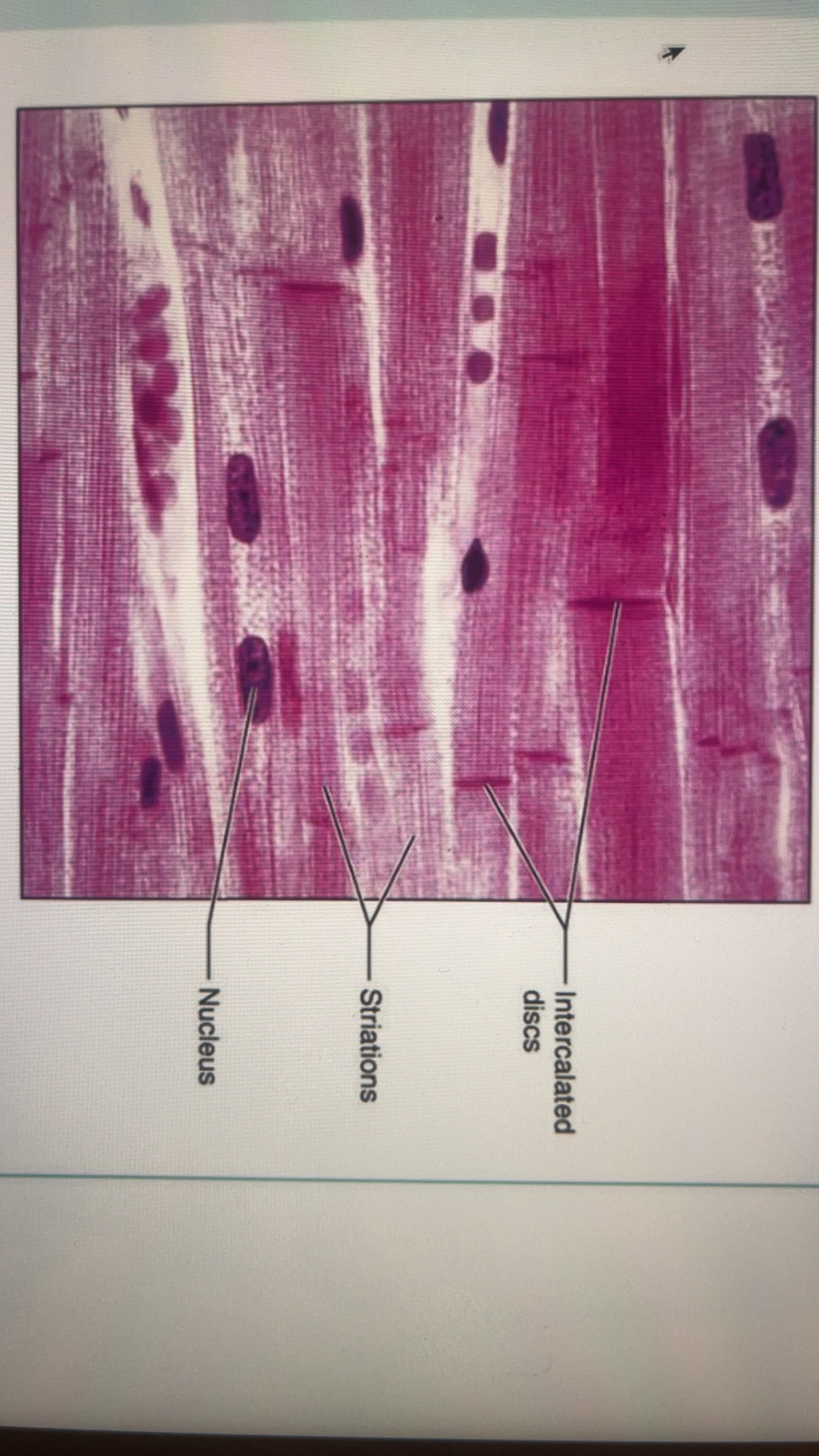 <ul><li><p>involuntary muscle </p></li><li><p>contains striations; cells only have 1 nucleus</p></li><li><p>have many branches that join other branches</p></li><li><p><strong><u>intercalated discs: </u></strong>special joints where cardiac muscles are joined</p></li><li><p>as it contracts, propels blood into the circulation </p></li></ul>