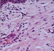 <p>What connective tissue cell is shown in the following image?</p>