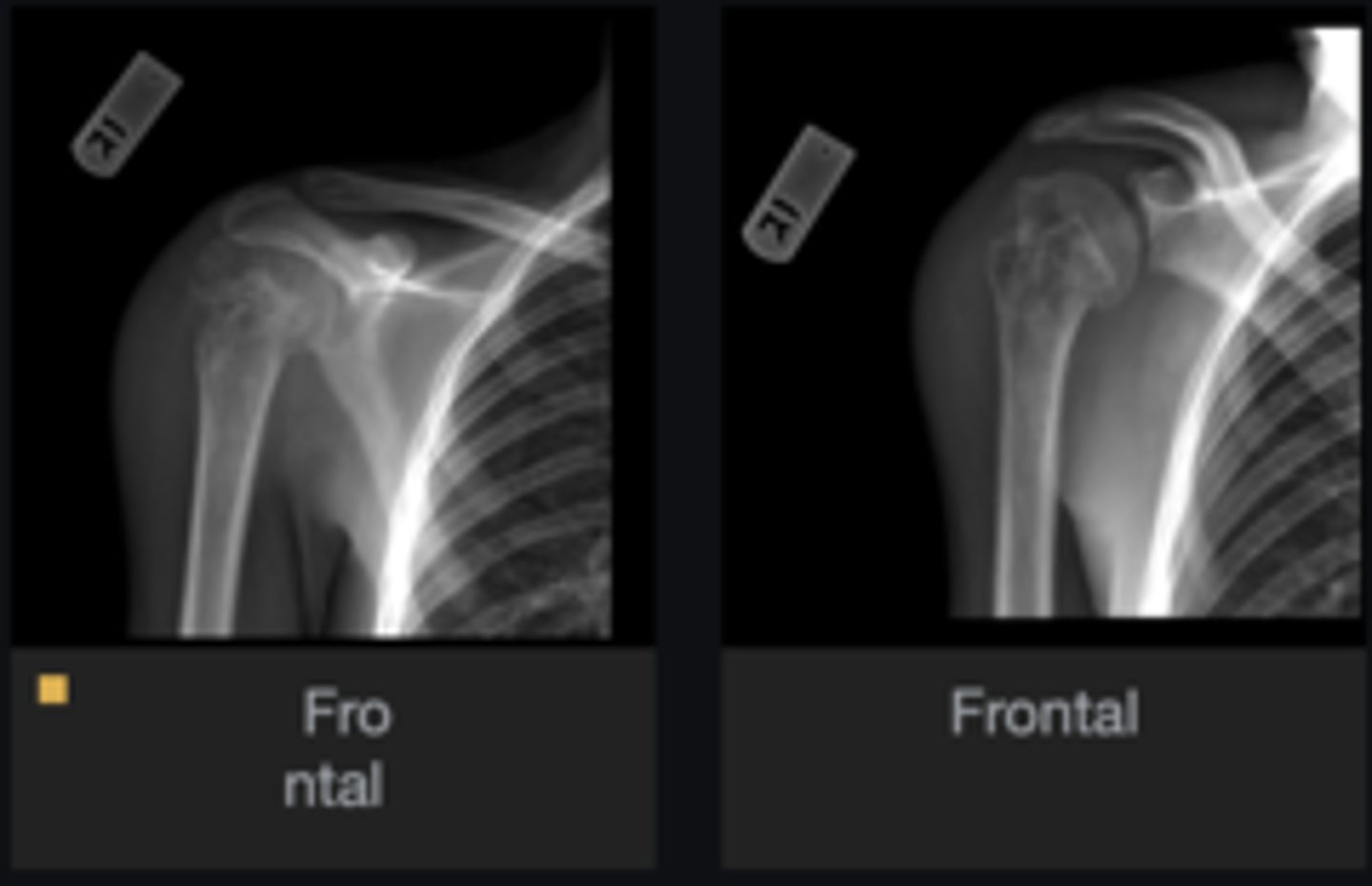<p>What is your differential diagnosis?</p>