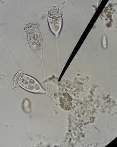 <p>cilite with a <span>cup-shaped cell, rimmed by cilia, and attached to a long stalk. It uses the stalk to attach to a substrate. When disturbed, this stalk coils tightly to retract</span></p>