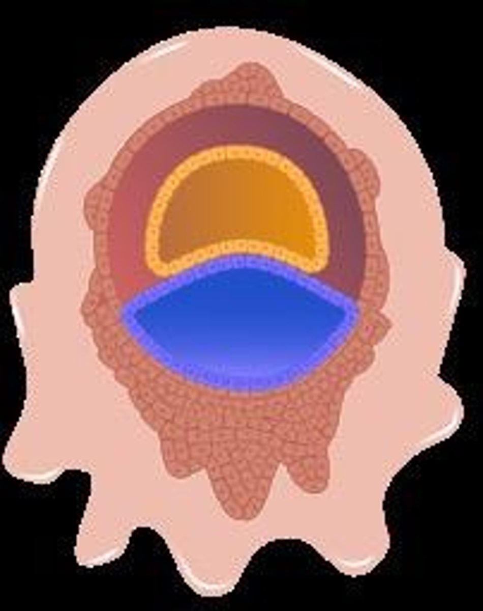 <p>The process where the blastocyst attaches to the uterine wall.</p>