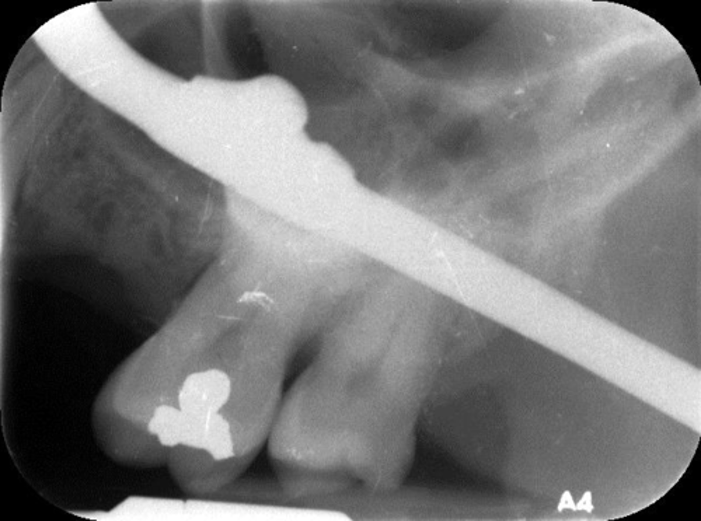 <p>What is this error?</p>