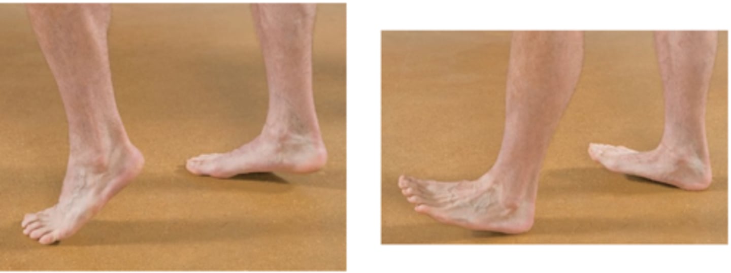 <p>Which one would be positive in a L5/S1 herniation?</p>