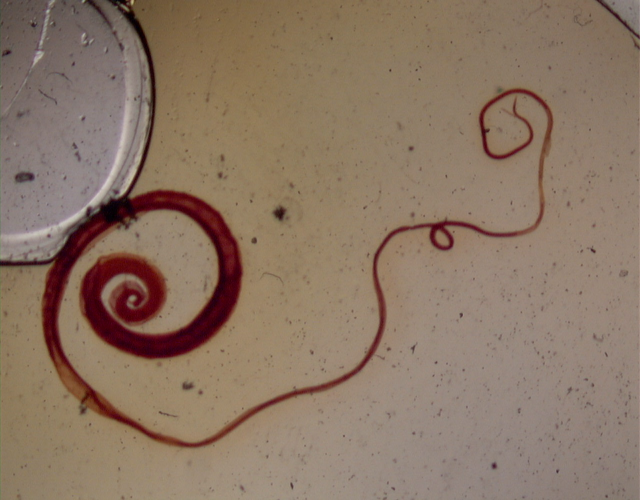 <p>in human stool</p><p>cecal mucosa inflammation, catarrhal enteritis, rectal prolapse, growth retardation, bloody/mucoid diarrhea</p><p>worldwide (common in tropics)</p>