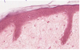 <p>stratified squamos epthitelial, keratinized</p>