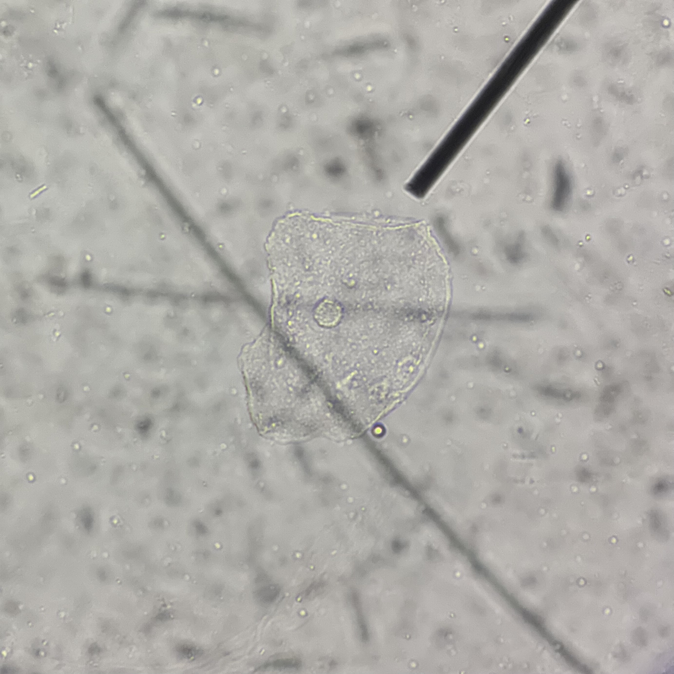 <p>Identify pointed structure.</p>