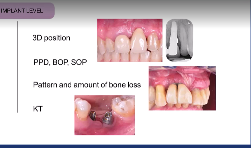 <ul><li><p>3D position of the implant</p></li><li><p>&nbsp;PDD, BOP, Suppuration on probing SOP</p></li><li><p>P attern and amount of bone loss (vertical bone loss around implant)</p></li><li><p>Presence of KT (presence of keratinized tissue)</p></li></ul><p></p>