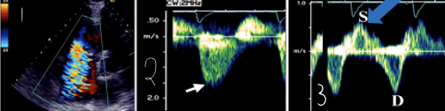 <p>1?</p>