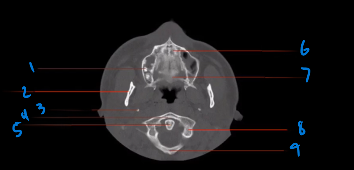 <p>Where is the hard palate located?</p>