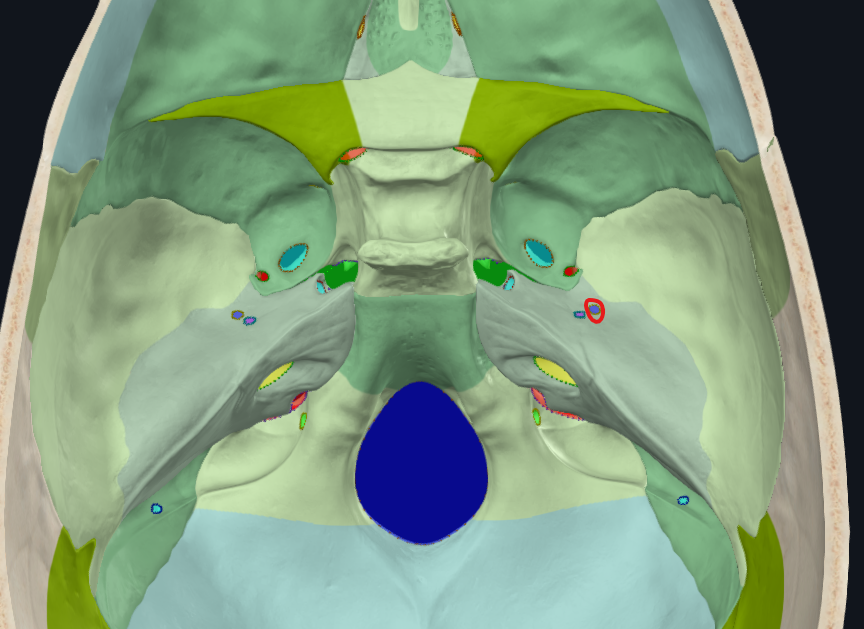 <ul><li><p>Fosa craneal media</p></li></ul><p></p>