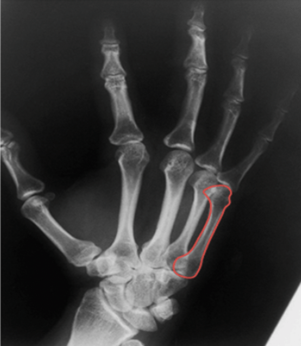 <p>What structure is highlighted?</p>