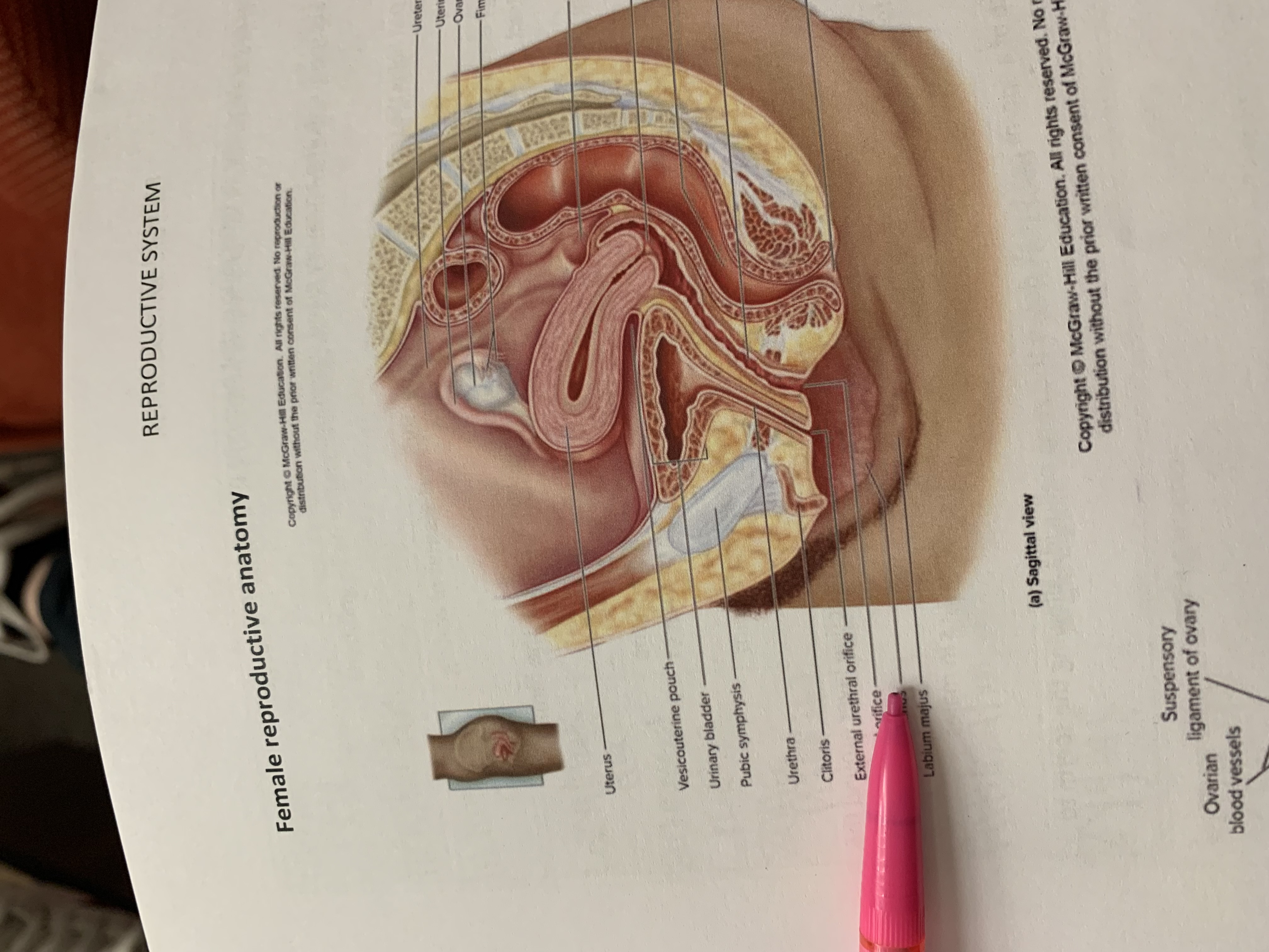 term image