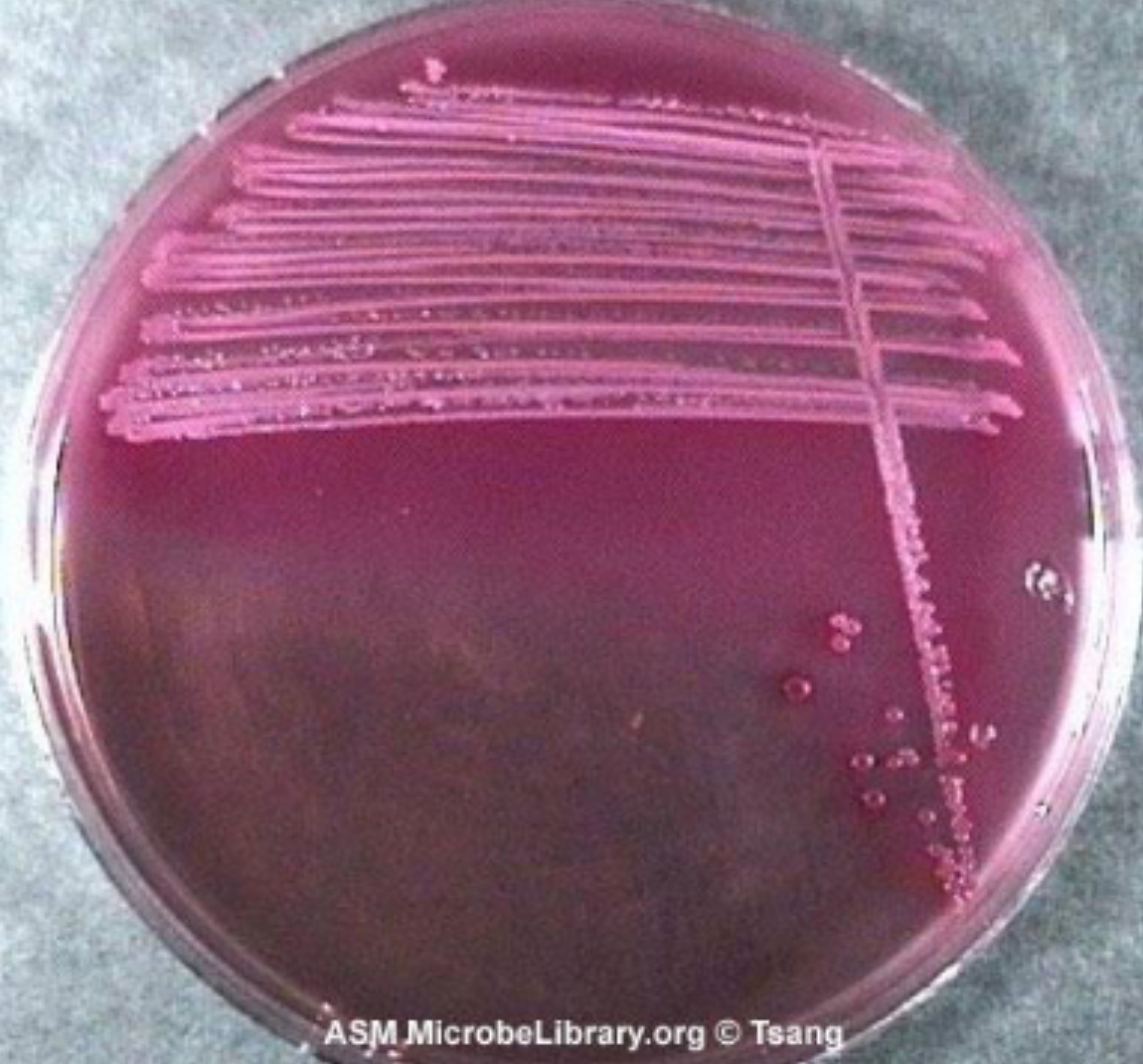 <p>MAC - Enterobacteriaceae</p>