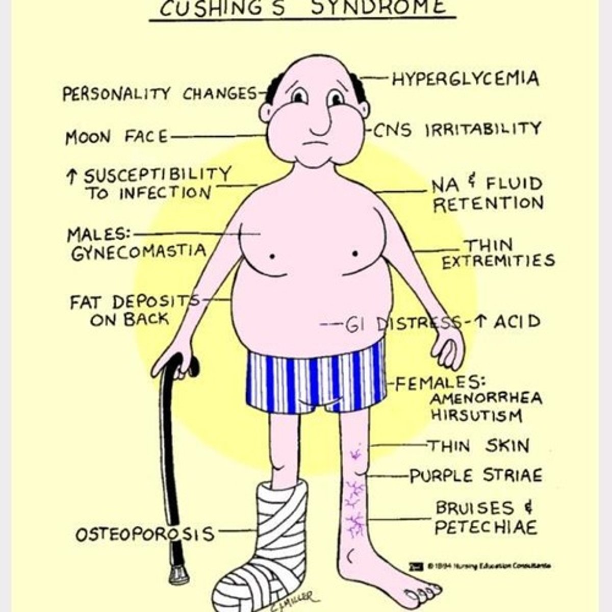 <p>High cortisol levels.</p>