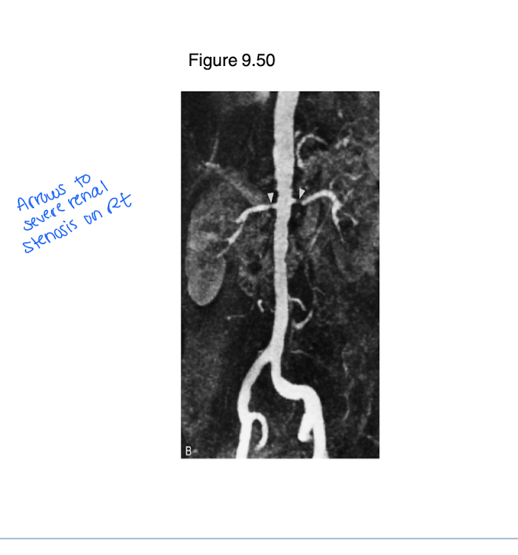 <p>Doppler u/s</p><p>Angiography</p>