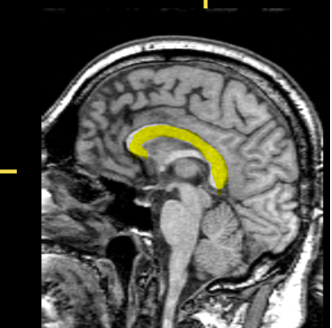 <p>What part of the brain is highlighted?</p>