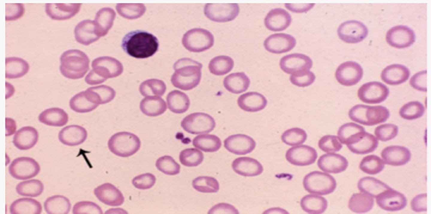 knowt flashcard image