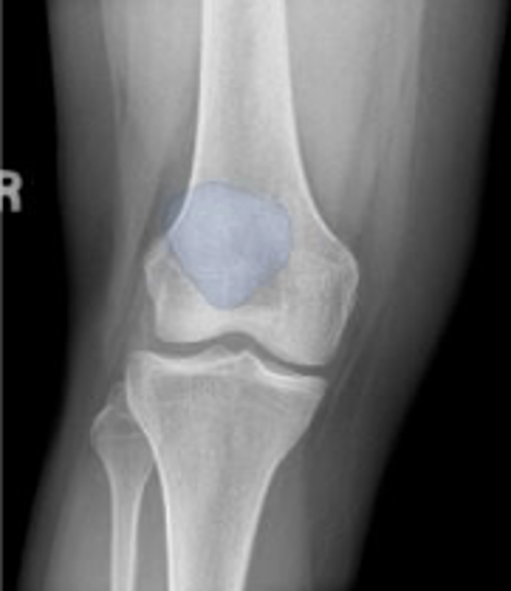 <p>What is outlined?</p>