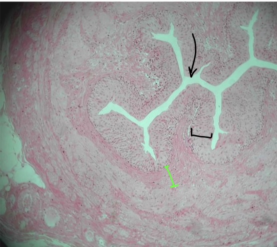 <p>specimen in field of view</p><p>space at tip of black arrow &amp; what it holds</p><p>specific tissue in black bracket</p><p>specific tissue in green bracket</p>