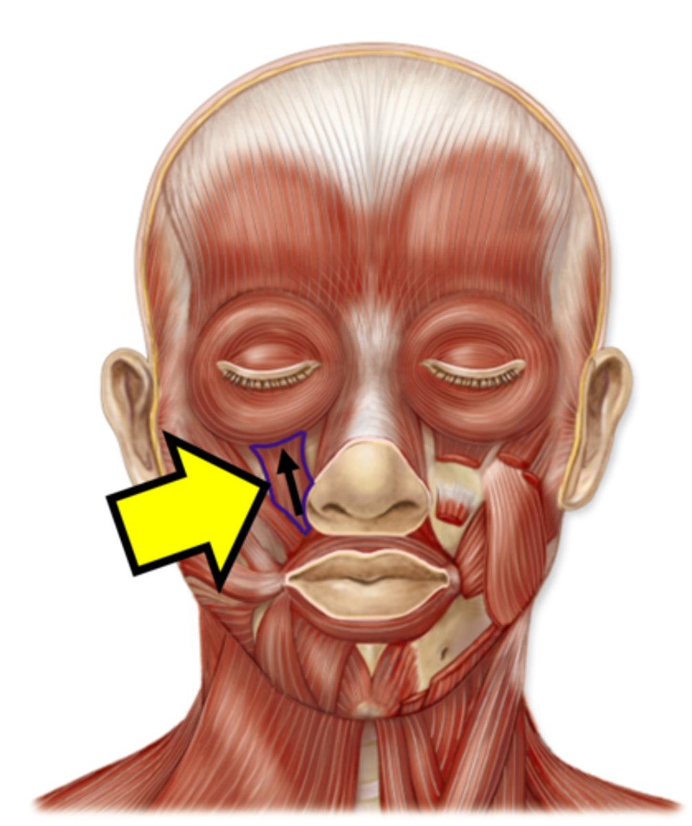 <p>Name the muscle.</p>