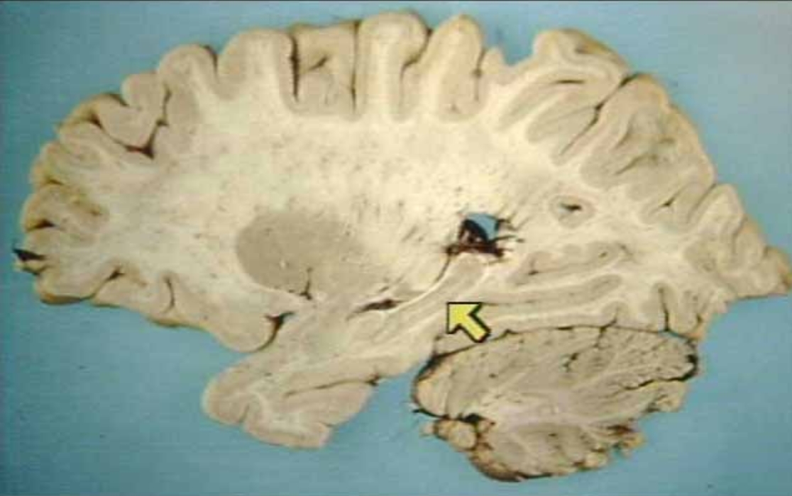 <p>What is the arrow pointing at?</p>