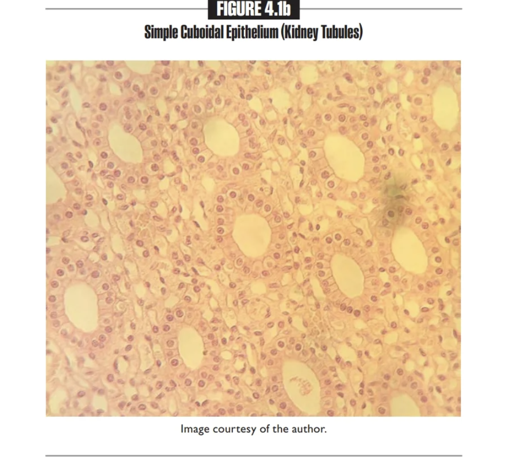 <p>Simple cuboidal epithelium</p><p></p>