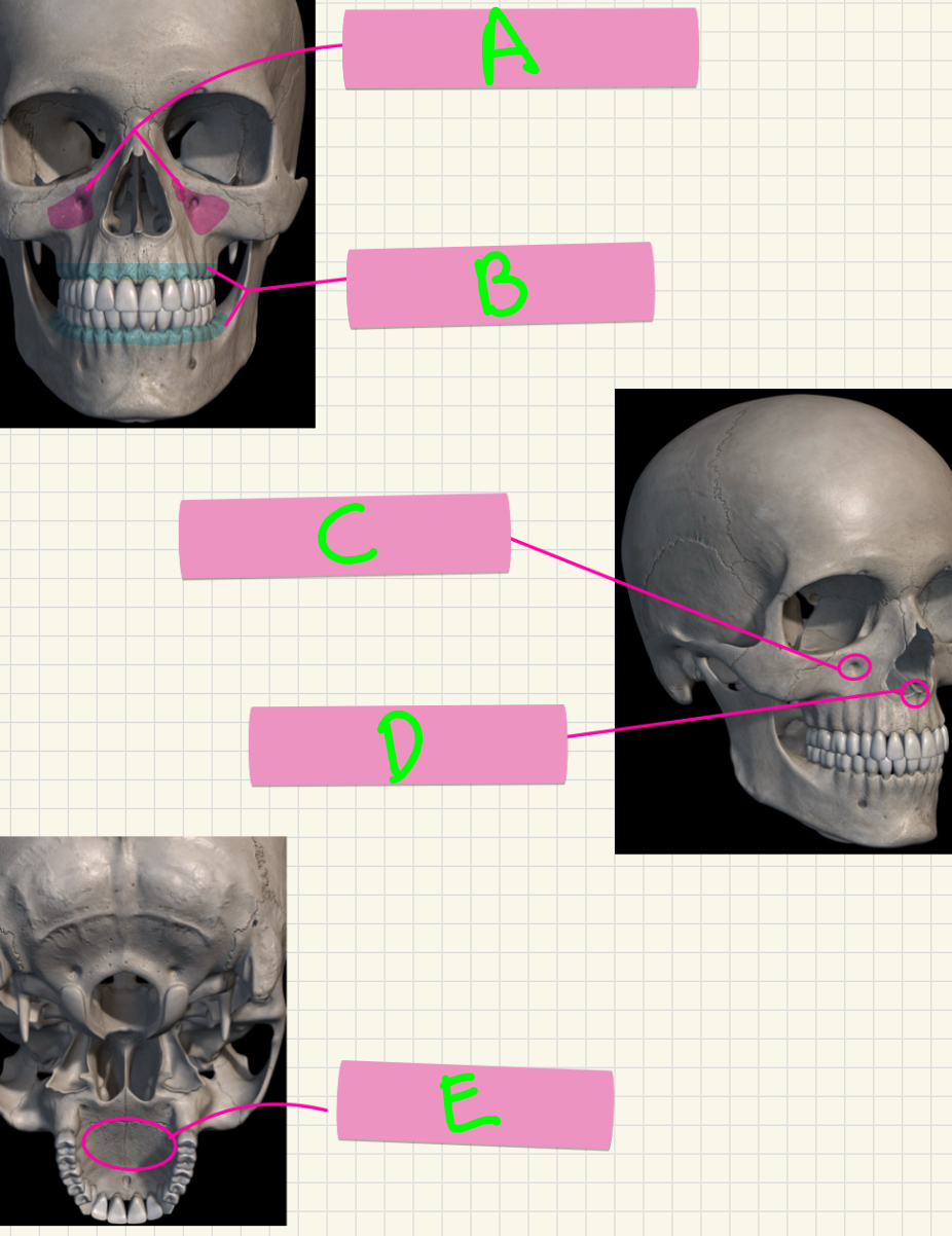 <p>What’s A-E?</p>