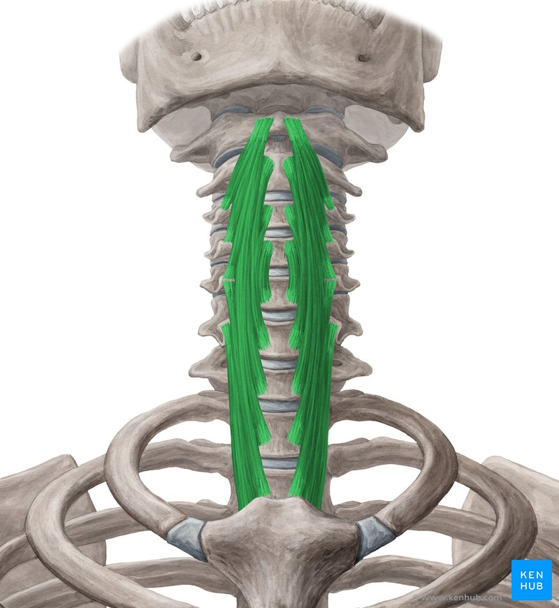 <p>Name the muscle</p>